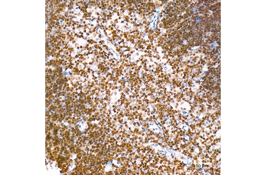 Immunohistochemistry - Anti-IKB zeta Antibody (A329476) - Antibodies.com