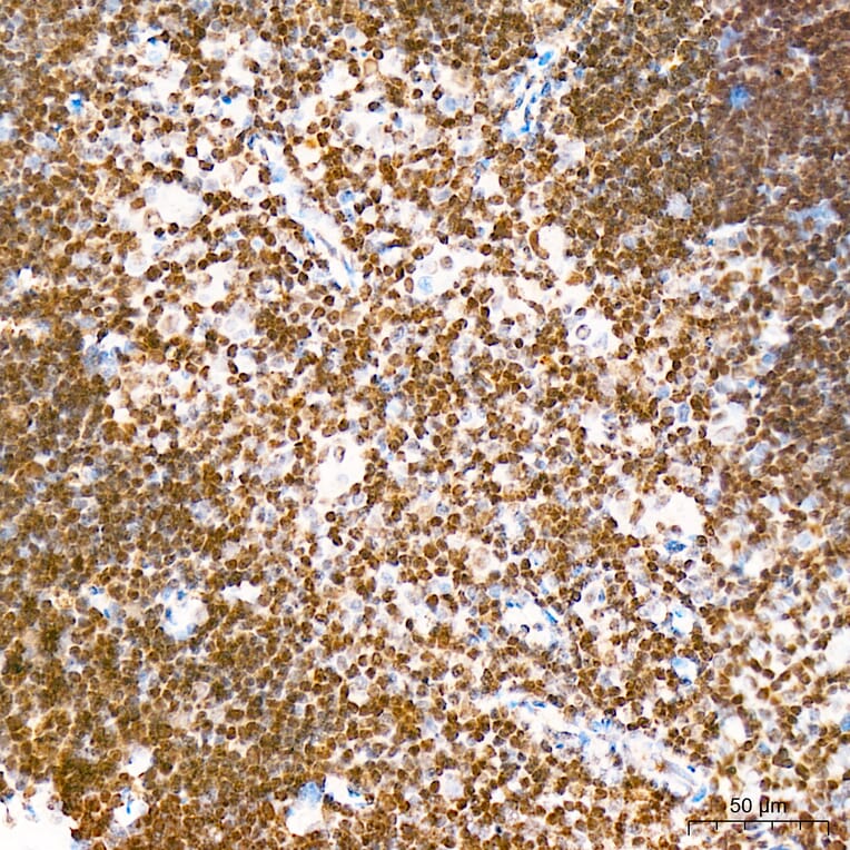 Immunohistochemistry - Anti-IKB zeta Antibody (A329476) - Antibodies.com