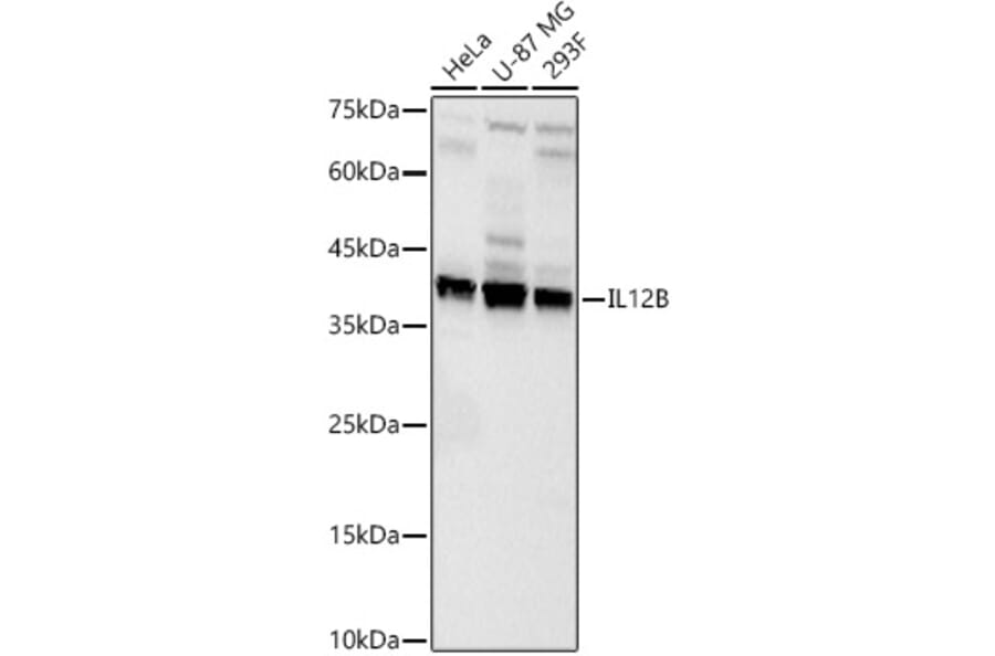 Western Blot - Anti-IL-12B Antibody (A329504) - Antibodies.com