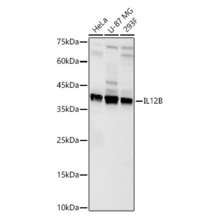 Western Blot - Anti-IL-12B Antibody (A329504) - Antibodies.com