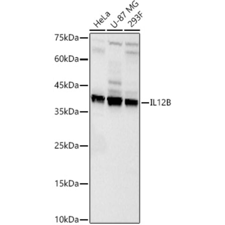 Western Blot - Anti-IL-12B Antibody (A329504) - Antibodies.com
