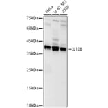 Western Blot - Anti-IL-12B Antibody (A329504) - Antibodies.com