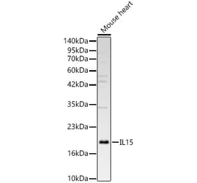 Western Blot - Anti-IL-15 Antibody (A329507) - Antibodies.com