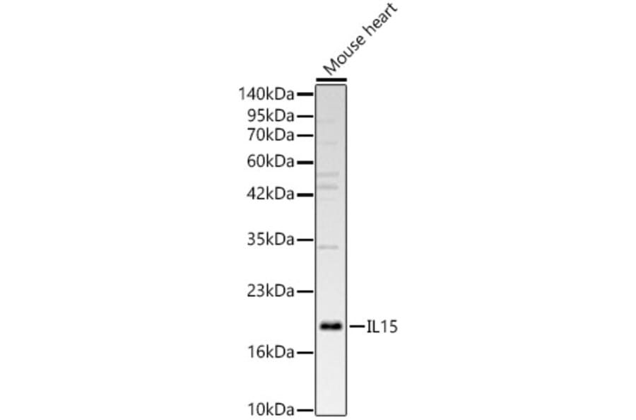 Western Blot - Anti-IL-15 Antibody (A329507) - Antibodies.com