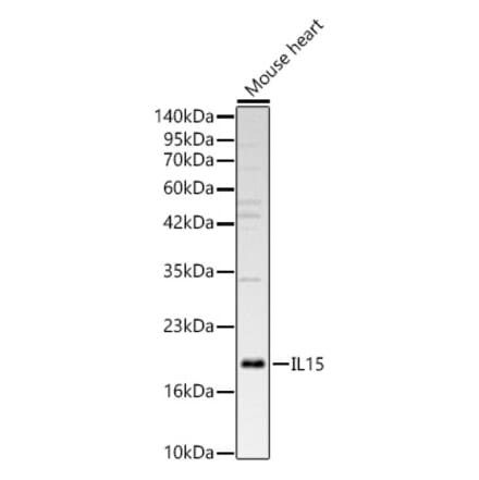 Western Blot - Anti-IL-15 Antibody (A329507) - Antibodies.com
