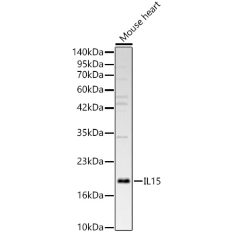 Western Blot - Anti-IL-15 Antibody (A329507) - Antibodies.com