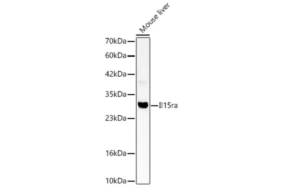 Western Blot - Anti-IL15ra Antibody (A329508) - Antibodies.com