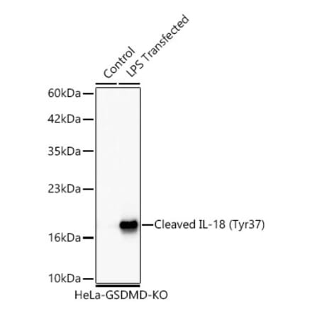 Western Blot - Anti-IL-18 Antibody [ARC64645] (A329511) - Antibodies.com
