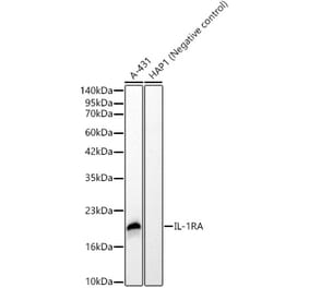 Western Blot - Anti-IL-1RA Antibody [ARC62499] (A329512) - Antibodies.com