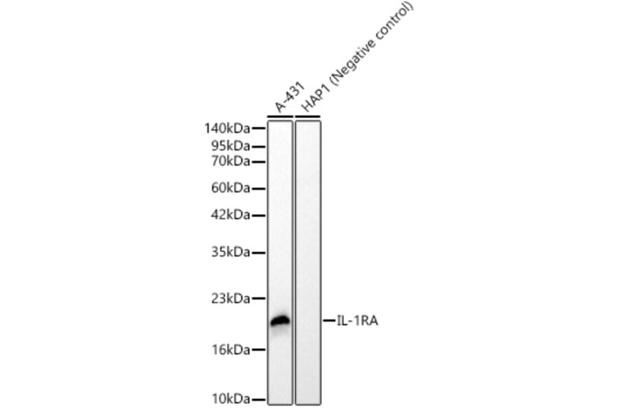 Western Blot - Anti-IL-1RA Antibody [ARC62499] (A329512) - Antibodies.com