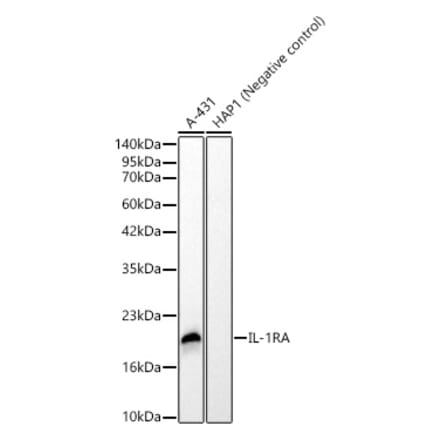 Western Blot - Anti-IL-1RA Antibody [ARC62499] (A329512) - Antibodies.com