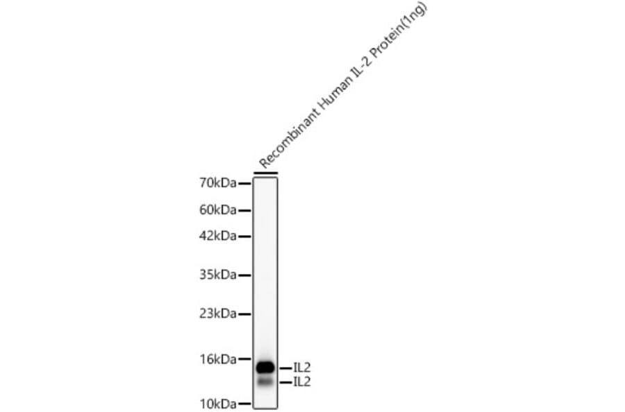 Western Blot - Anti-IL-2 Antibody [ARC55030] (A329513) - Antibodies.com