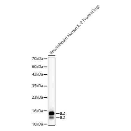 Western Blot - Anti-IL-2 Antibody [ARC55030] (A329513) - Antibodies.com