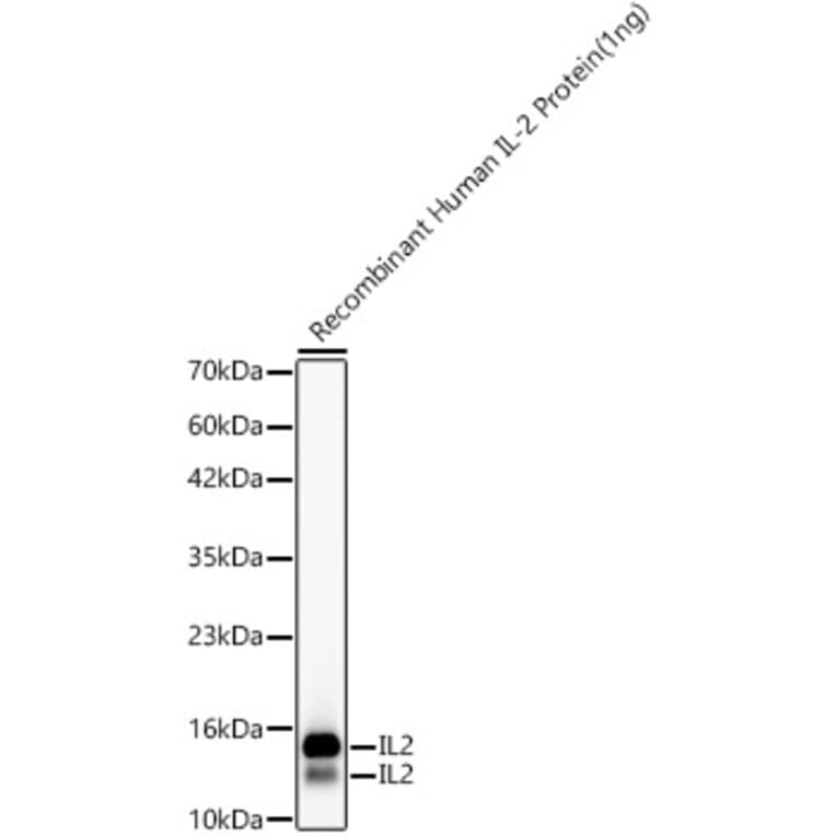 Western Blot - Anti-IL-2 Antibody [ARC55030] (A329513) - Antibodies.com