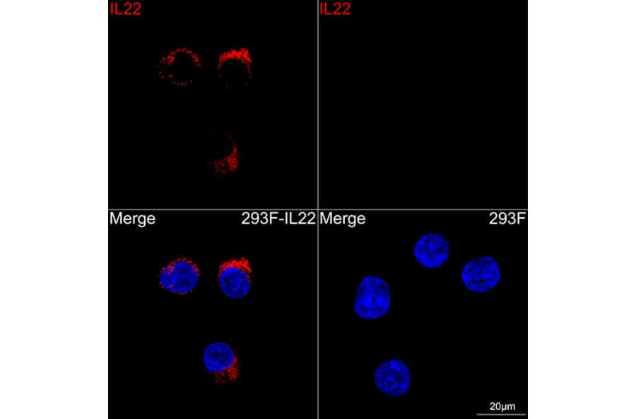 Immunofluorescence - Anti-IL-22 Antibody [ARC63986] (A329514) - Antibodies.com
