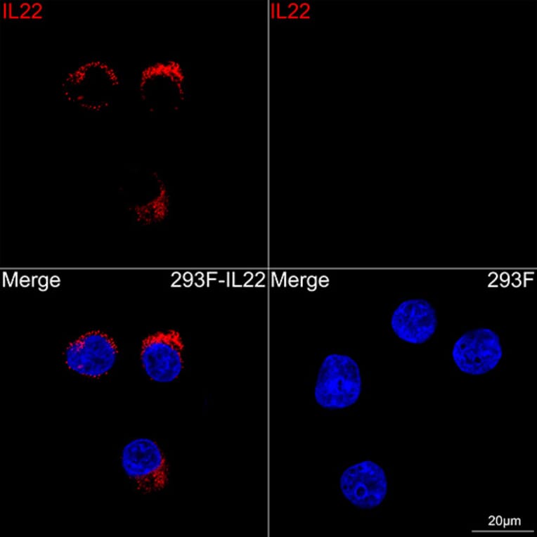Immunofluorescence - Anti-IL-22 Antibody [ARC63986] (A329514) - Antibodies.com