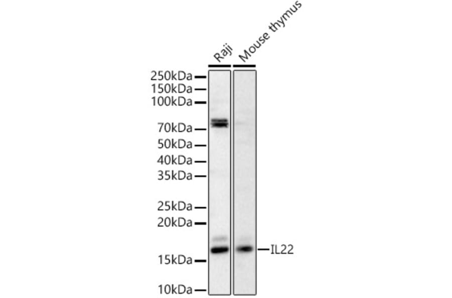 Western Blot - Anti-IL-22 Antibody (A329515) - Antibodies.com