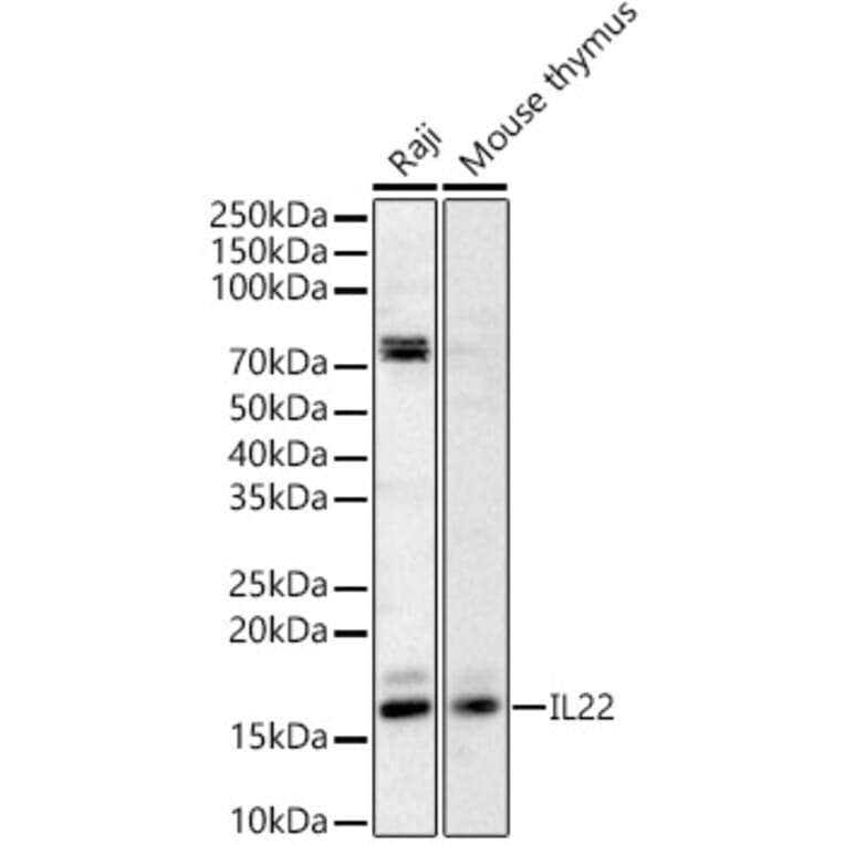 Western Blot - Anti-IL-22 Antibody (A329515) - Antibodies.com