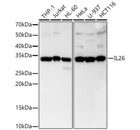 Western Blot - Anti-IL-26 Antibody [ARC3088] (A329516) - Antibodies.com