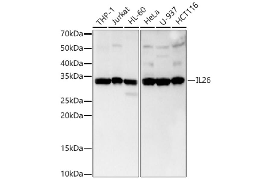 Western Blot - Anti-IL-26 Antibody [ARC3088] (A329516) - Antibodies.com