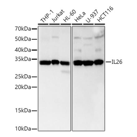 Western Blot - Anti-IL-26 Antibody [ARC3088] (A329516) - Antibodies.com
