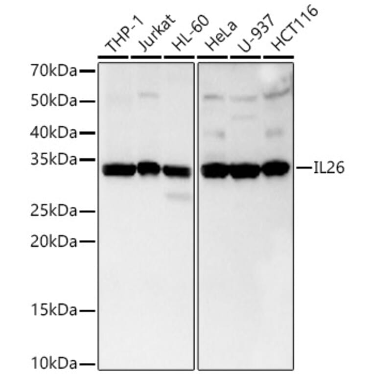 Western Blot - Anti-IL-26 Antibody [ARC3088] (A329516) - Antibodies.com