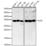 Western Blot - Anti-IL-26 Antibody [ARC3088] (A329516) - Antibodies.com