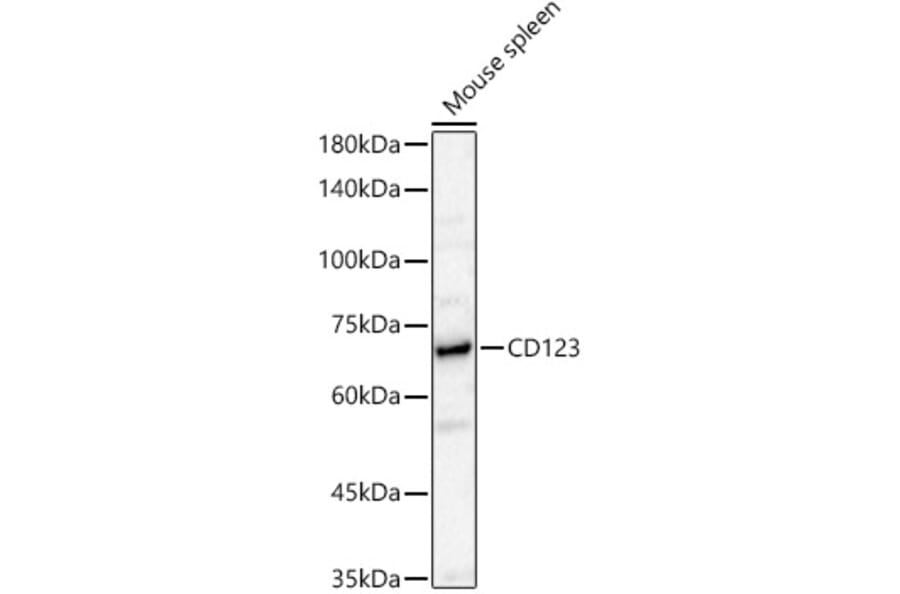 Western Blot - Anti-IL3RA Antibody (A329522) - Antibodies.com
