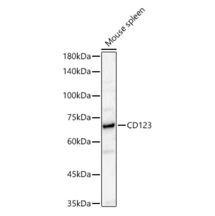 Western Blot - Anti-IL3RA Antibody (A329522) - Antibodies.com