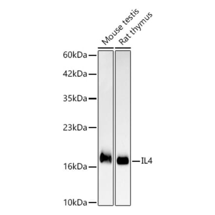 Western Blot - Anti-IL-4 Antibody [ARC61989] (A329525) - Antibodies.com