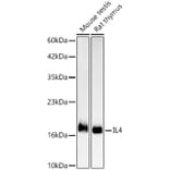 Western Blot - Anti-IL-4 Antibody [ARC61989] (A329525) - Antibodies.com