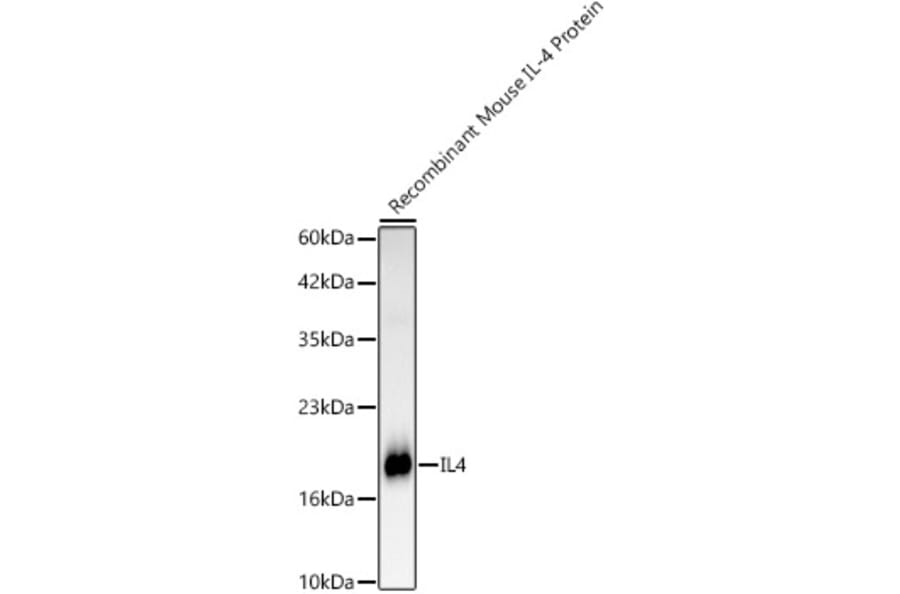 Western Blot - Anti-IL-4 Antibody [ARC61989] (A329525) - Antibodies.com