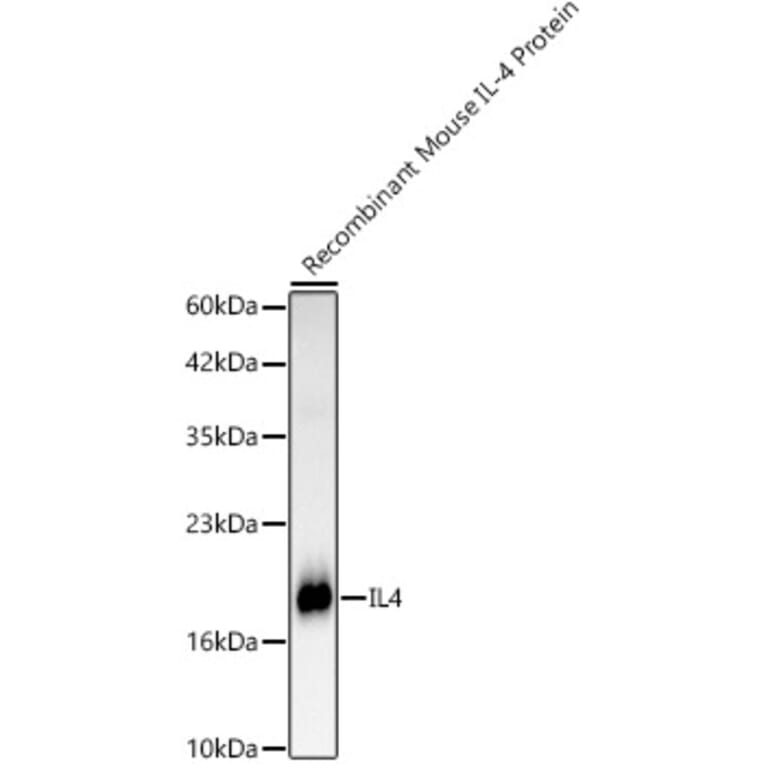 Western Blot - Anti-IL-4 Antibody [ARC61989] (A329525) - Antibodies.com