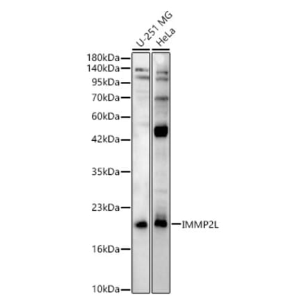 Western Blot - Anti-IMMP2L Antibody (A329532) - Antibodies.com