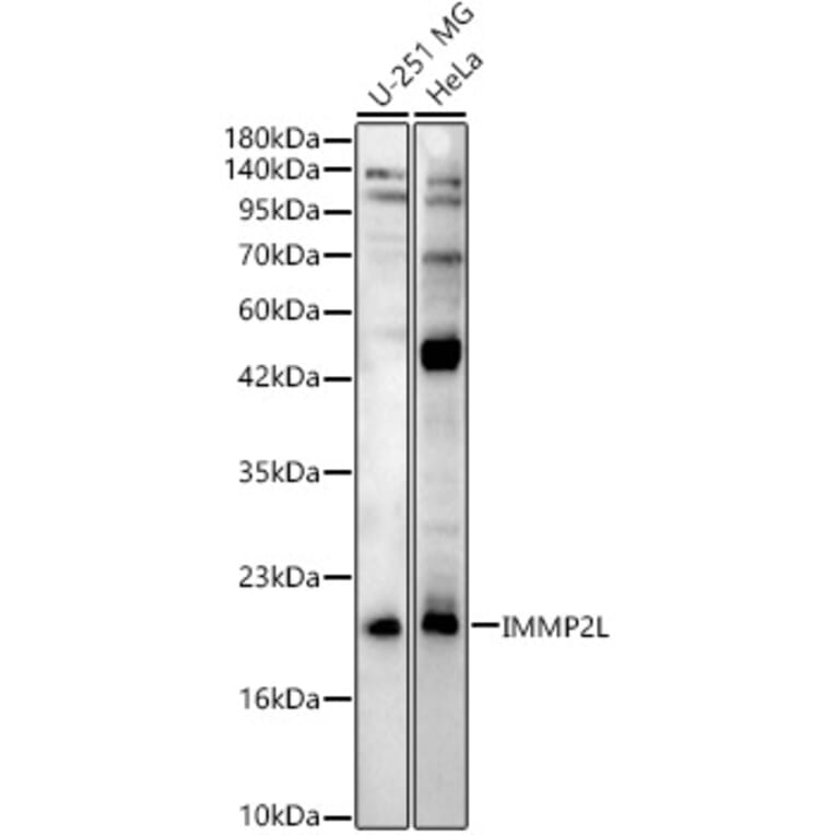 Western Blot - Anti-IMMP2L Antibody (A329532) - Antibodies.com