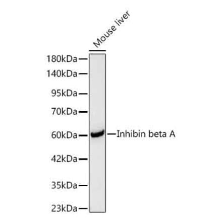 Western Blot - Anti-Inhibin beta A Antibody (A329533) - Antibodies.com