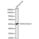 Western Blot - Anti-Inhibin beta A Antibody (A329533) - Antibodies.com