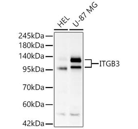 Western Blot - Anti-Integrin beta 3 Antibody (A329535) - Antibodies.com