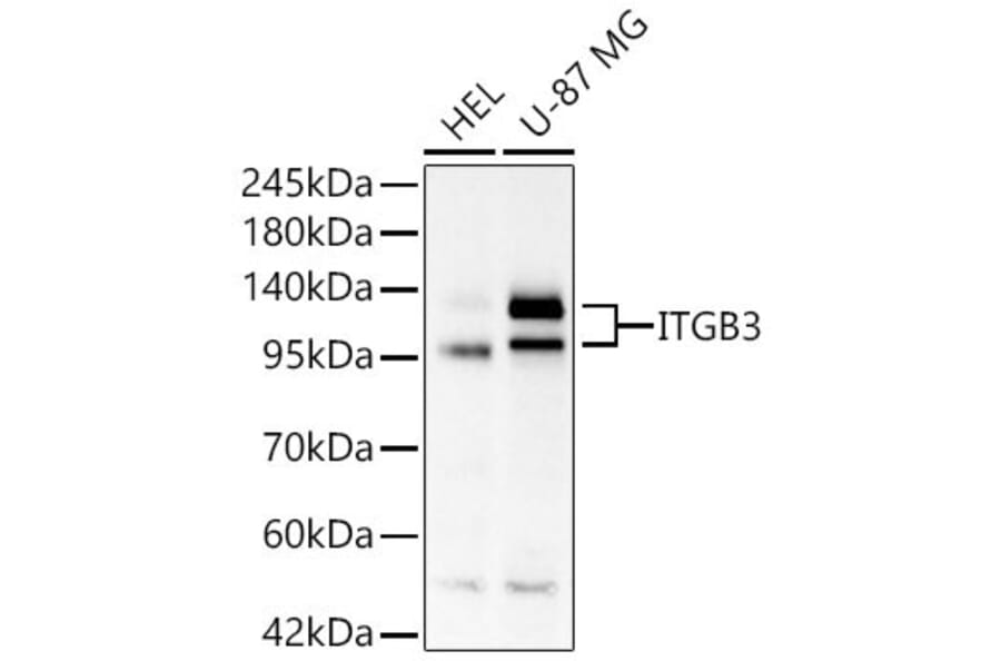 Western Blot - Anti-Integrin beta 3 Antibody (A329535) - Antibodies.com