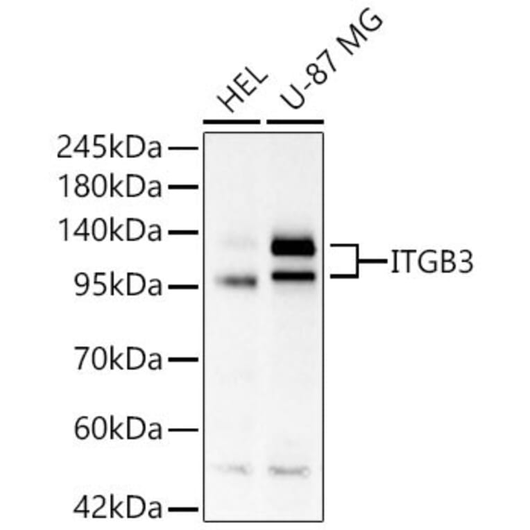 Western Blot - Anti-Integrin beta 3 Antibody (A329535) - Antibodies.com
