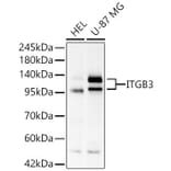 Western Blot - Anti-Integrin beta 3 Antibody (A329535) - Antibodies.com