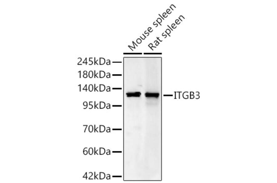 Western Blot - Anti-Integrin beta 3 Antibody (A329535) - Antibodies.com