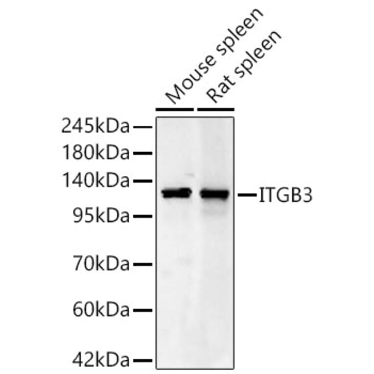 Western Blot - Anti-Integrin beta 3 Antibody (A329535) - Antibodies.com