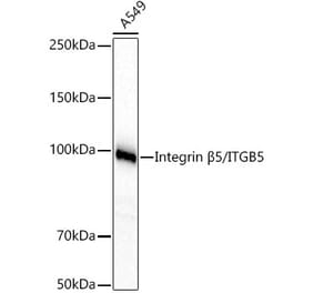Western Blot - Anti-Integrin beta 5 Antibody [ARC60869] (A329536) - Antibodies.com