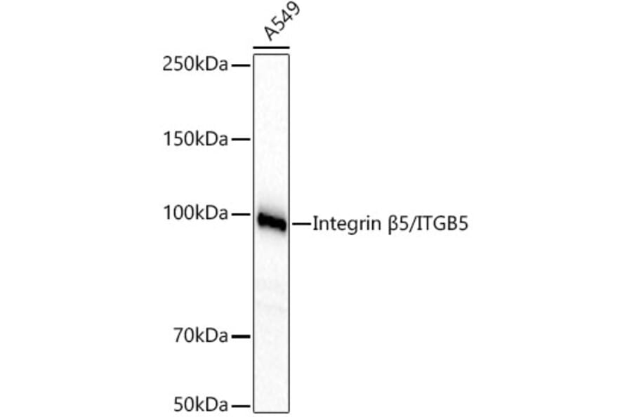 Western Blot - Anti-Integrin beta 5 Antibody [ARC60869] (A329536) - Antibodies.com