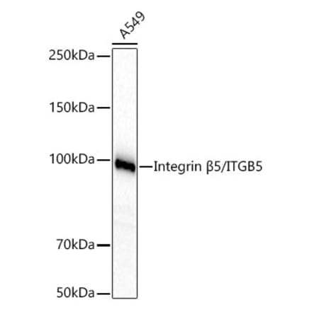 Western Blot - Anti-Integrin beta 5 Antibody [ARC60869] (A329536) - Antibodies.com