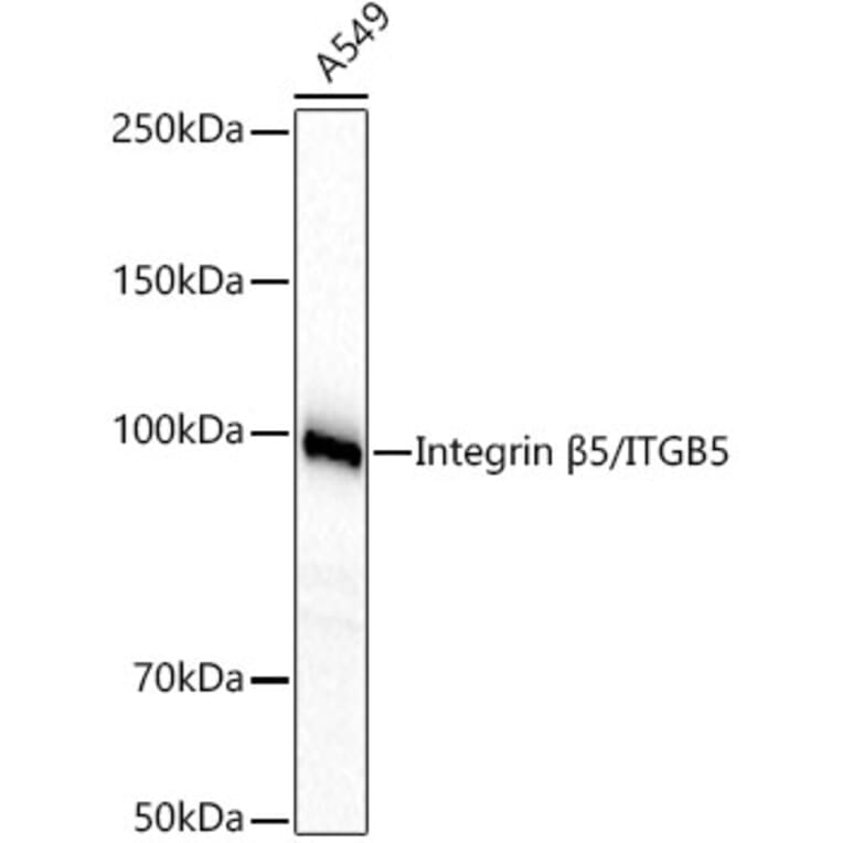 Western Blot - Anti-Integrin beta 5 Antibody [ARC60869] (A329536) - Antibodies.com