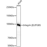 Western Blot - Anti-Integrin beta 5 Antibody [ARC60869] (A329536) - Antibodies.com