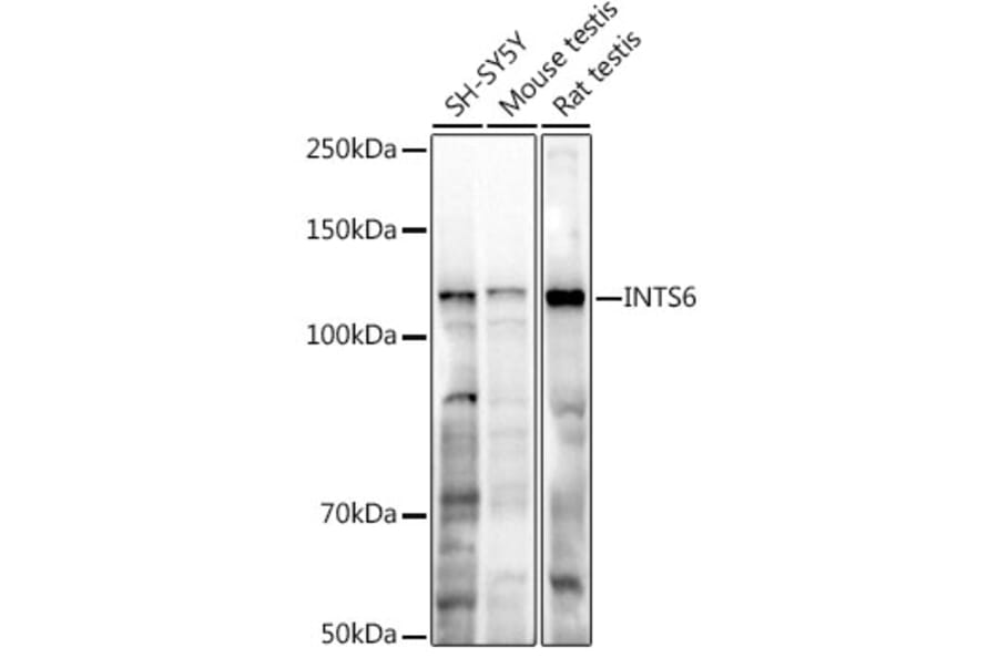 Western Blot - Anti-INTS6 Antibody (A329539) - Antibodies.com