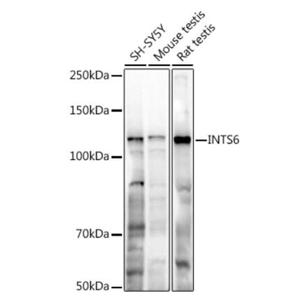 Western Blot - Anti-INTS6 Antibody (A329539) - Antibodies.com